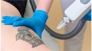 رفع تتو پوست و ابرو کد 27