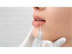 تزریق لیپ فلیپ Lip flip کد 34