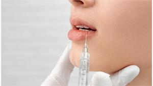 تزریق لیپ فلیپ Lip flip کد 34