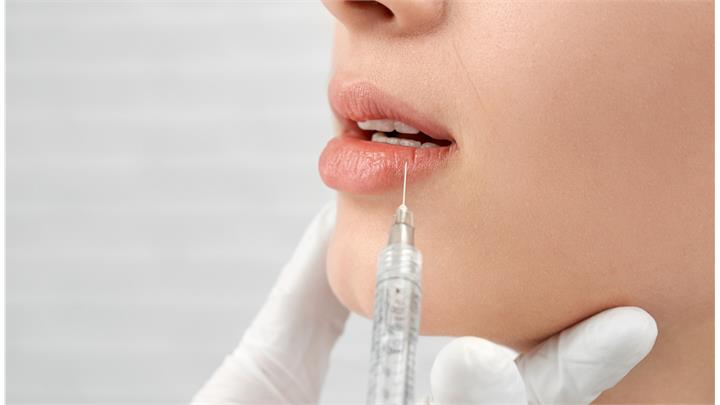 تزریق لیپ فلیپ Lip flip