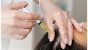 مزونیدلینگ مو کد 08