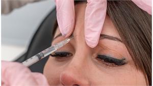 ژل پیشانی کد 20