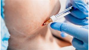 ژل زاویه سازی فک کد 26