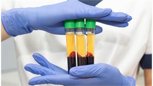 PRP پوست کد 12