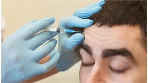 ژل شقیقه کد 19