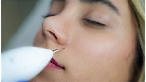 خال برداری صورت و بدن کد 15