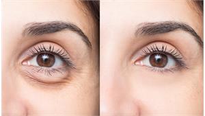 ژل زیر چشم کد 21