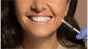 ژل خط خنده کد 23