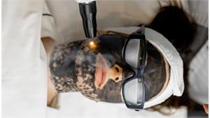 کربن پیل پوست کد 16