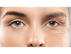 پیش گیری از افتادگی صورت کد 32